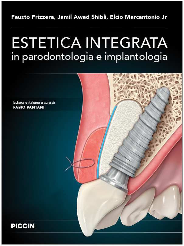 Estetica integrata in parodontologia e implantologia