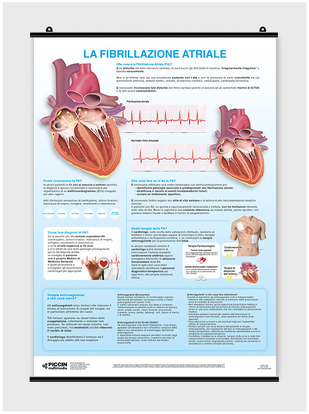 La fibrillazione atriale - per il paziente - Poster