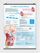 La fibrillazione atriale - per il paziente - Poster