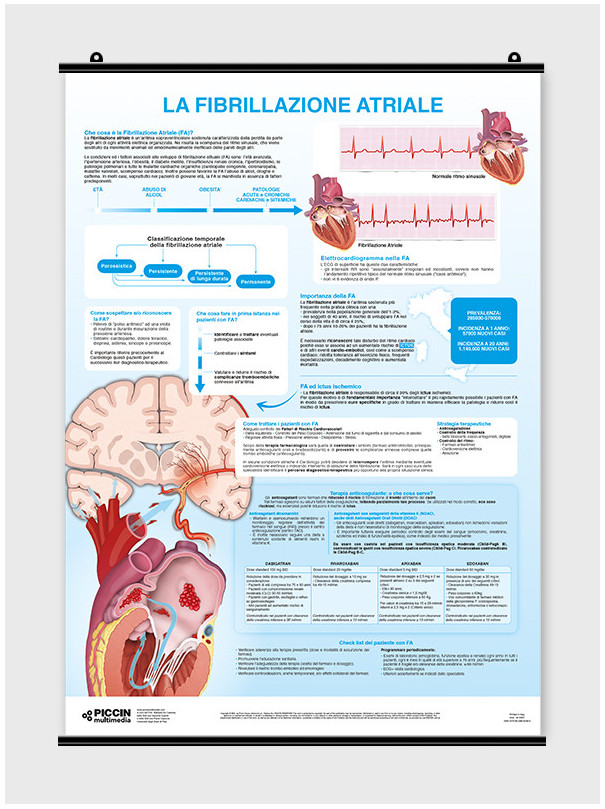 La fibrillazione atriale - per il medico - Poster