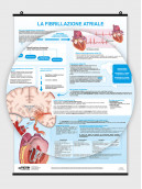 La fibrillazione atriale - per il medico - Poster