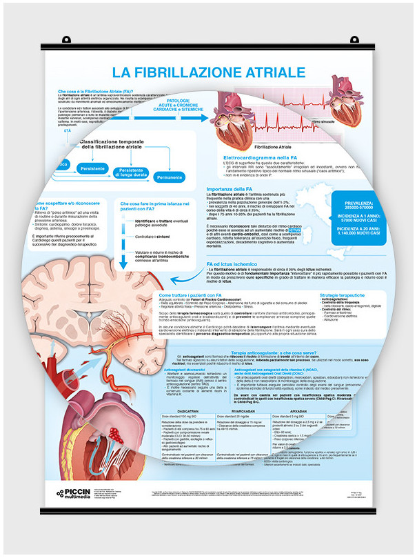 La fibrillazione atriale - per il paziente - Poster