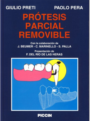 Pròtesis Parcial Removible