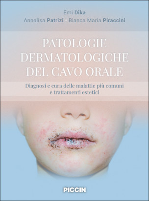 Patologie dermatologiche del cavo orale