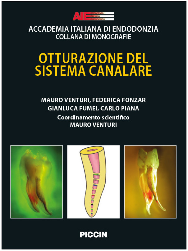 OTTURAZIONE DEL SISTEMA CANALARE