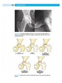 Ortopedia e Traumatologia