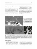 Neurochirurgia moderna