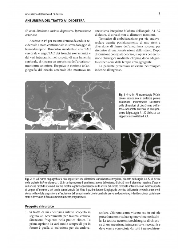 Neurochirurgia moderna