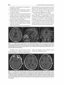 Neurochirurgia moderna