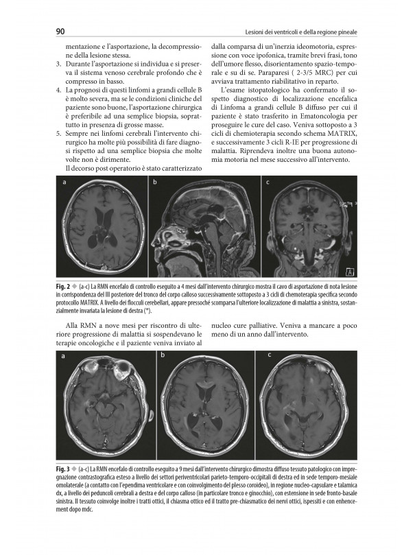 Neurochirurgia moderna