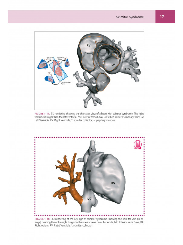 Congenital heARts - A Virtual Atlas of Congenital Heart Disease in Prenatal and Postnatal Life