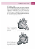 Congenital heARts - A Virtual Atlas of Congenital Heart Disease in Prenatal and Postnatal Life