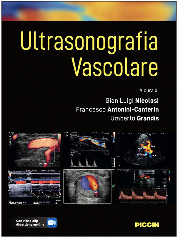 ULTRASONOGRAFIA VASCOLARE