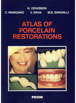 Atlas of porcelain restorations