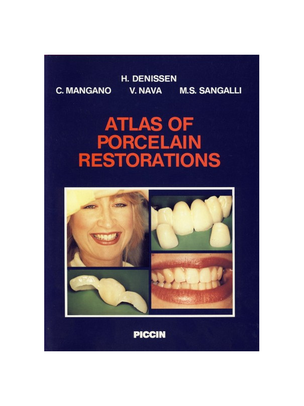 Atlas of porcelain restorations