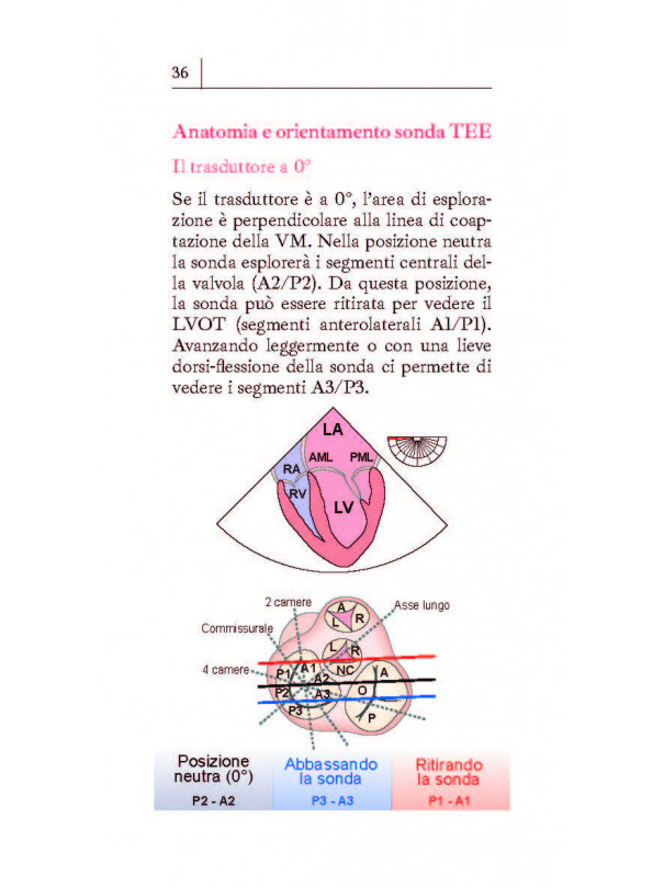 Ecocardiografia transesofagea con ECO 3D