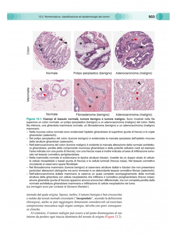 Patogenesi-Basi genetiche e molecolari delle malattie