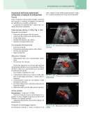 ULTRASONOGRAFIA VASCOLARE