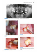 Odontostomatologia per l’igienista dentale - Basi Anatomo-Cliniche e Protocolli Operativi