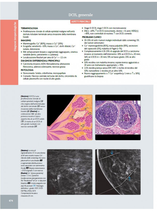 La mammella. Diagnostica per immagini