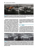 ECOGRAFIA MUSCOLOSCHELETRICA in Patologia Ortopedica e Reumatologica