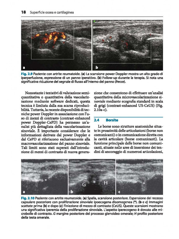 ECOGRAFIA MUSCOLOSCHELETRICA in Patologia Ortopedica e Reumatologica