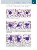 Casi clinici in Medicina di Laboratorio - Ematologia