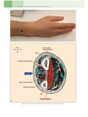 Elettromiografia e Disordini neuromuscolari: Correlazioni clinico-elettrofisiologiche ed ecografiche