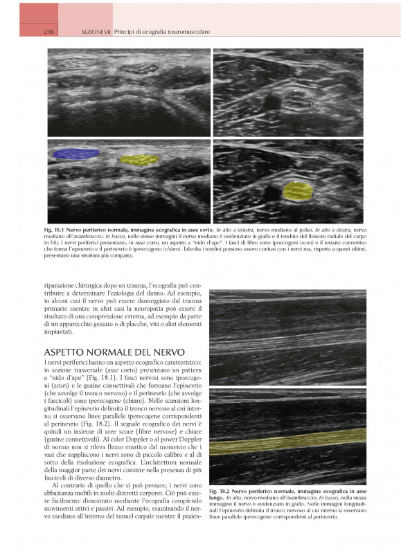 Elettromiografia e Disordini neuromuscolari: Correlazioni clinico-elettrofisiologiche ed ecografiche