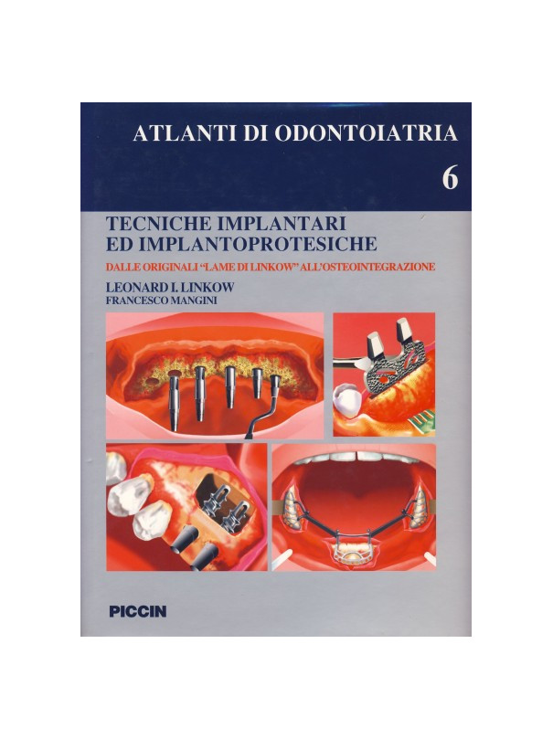Tecniche Implantari ed Implantoprotesiche - Vol . 6