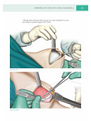 Chirurgia Oncoplastica della Mammella-Atlante di tecniche chiurgiche