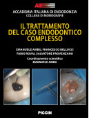 IL TRATTAMENTO DEL CASO ENDODONTICO COMPLESSO