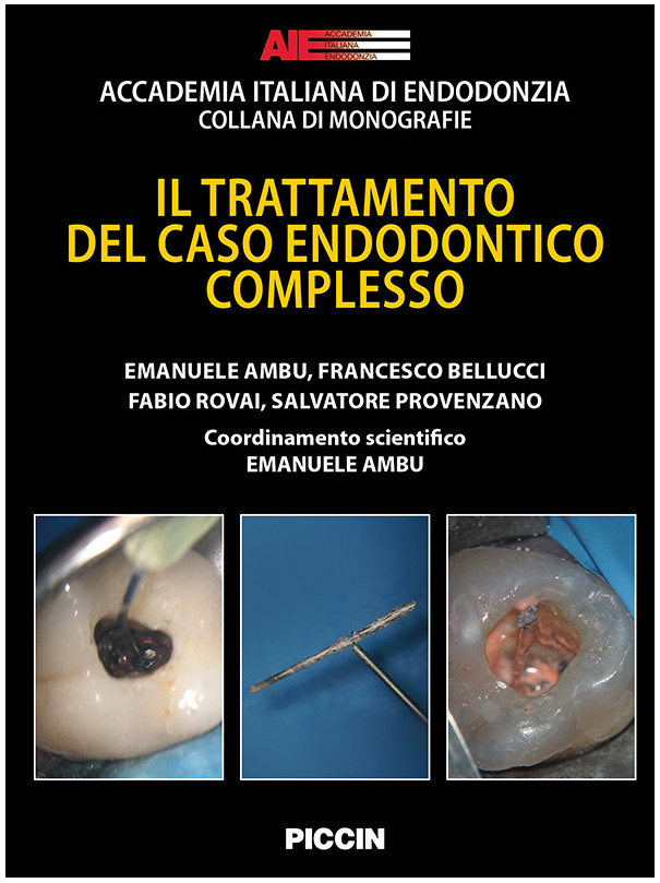 IL TRATTAMENTO DEL CASO ENDODONTICO COMPLESSO