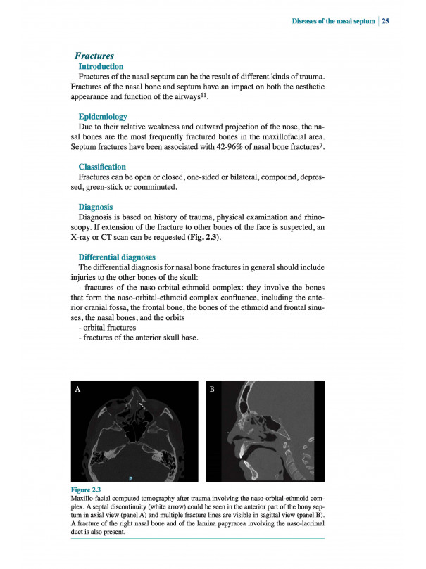 The Nasal Septum