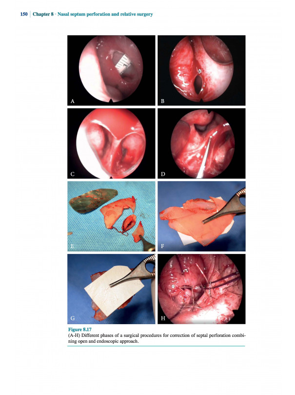 The Nasal Septum