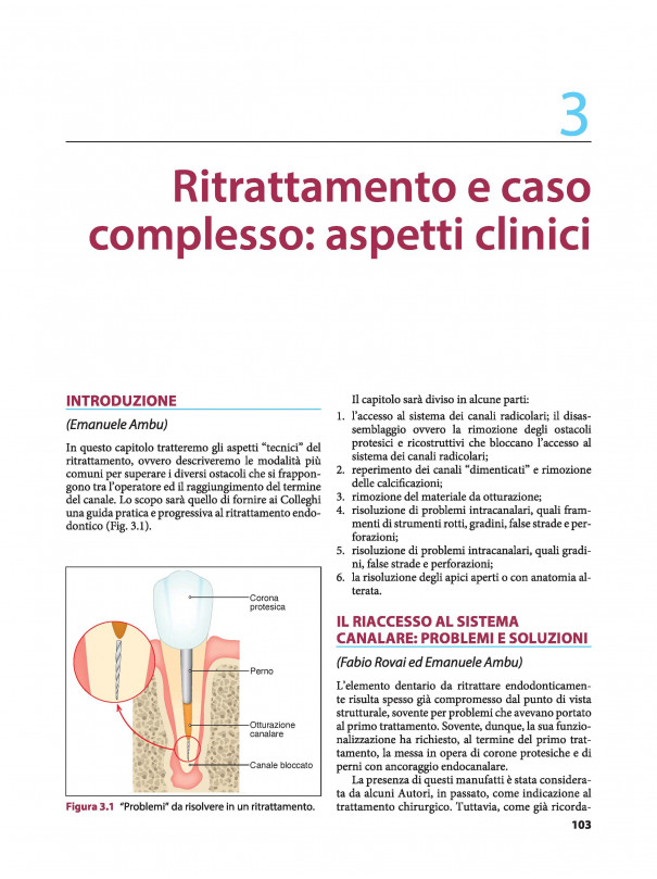 IL TRATTAMENTO DEL CASO ENDODONTICO COMPLESSO