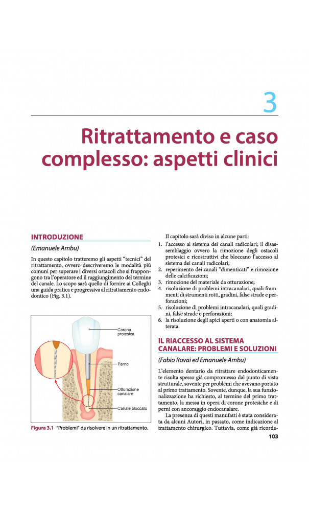 IL TRATTAMENTO DEL CASO ENDODONTICO COMPLESSO