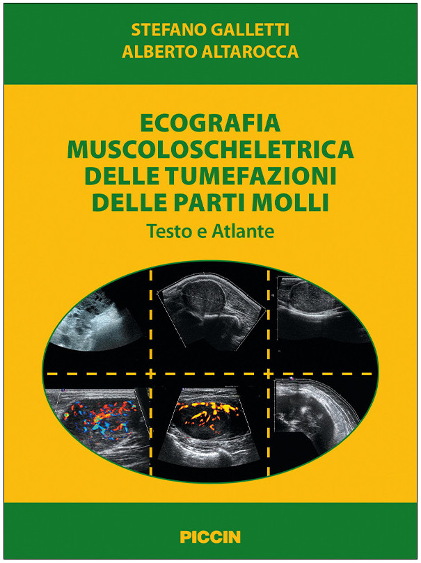 Ecografia muscoloscheletrica delle tumefazioni delle parti molli