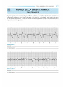 ECG WORKOUT - ESERCIZI DI INTERPRETAZIONE delle ARITMIE CARDIACHE