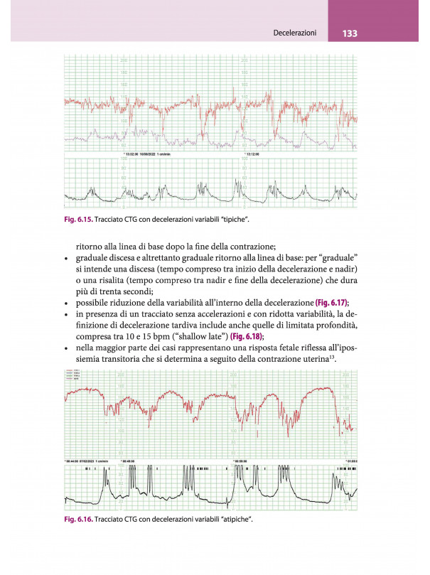 La lettura fisiopatologica della cardiotocografia intrapartum