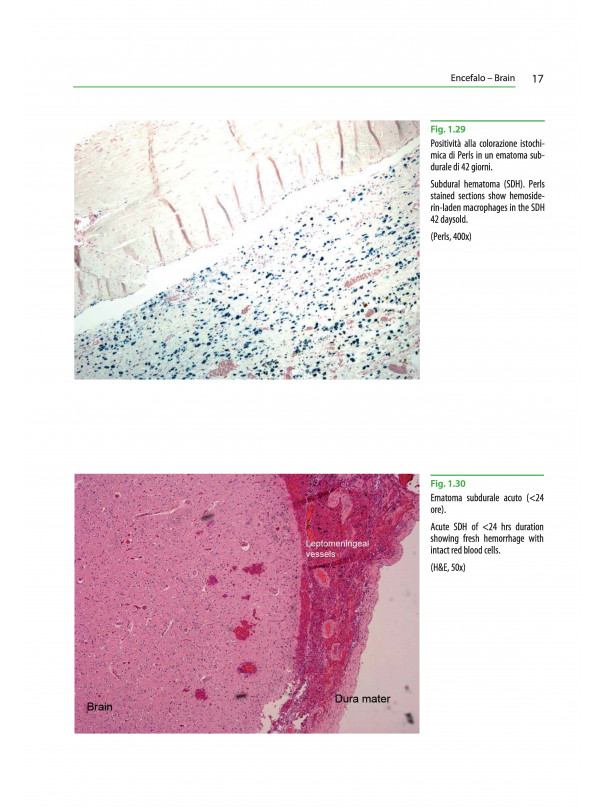 Atlante di istopatologia forense