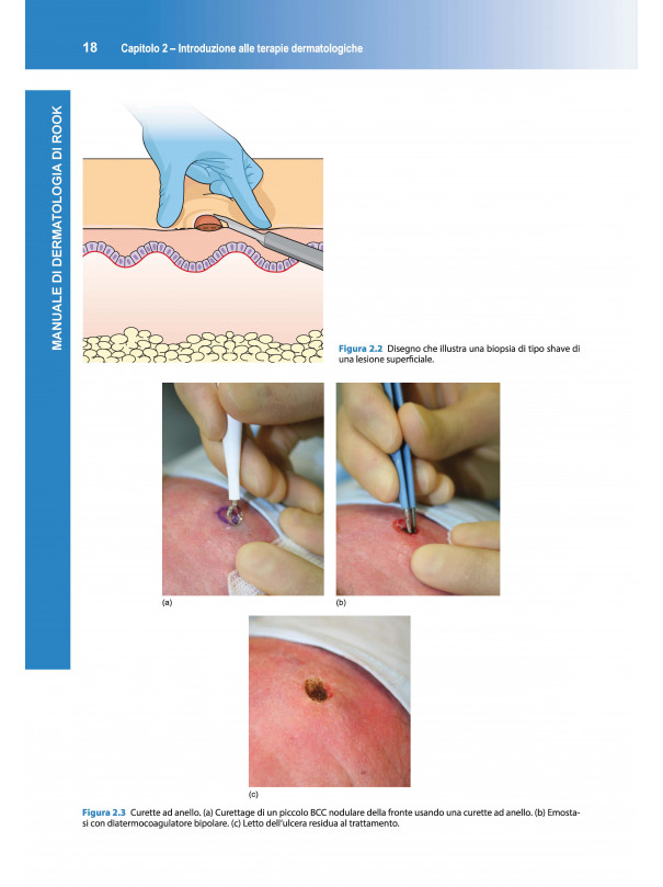 Manuale di Dermatologia di Rook