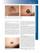 Manuale di Dermatologia di Rook