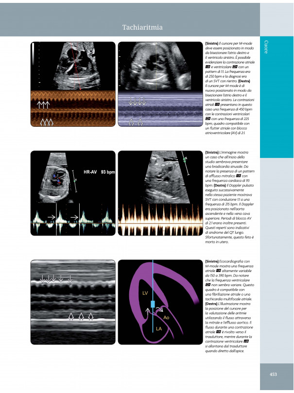 Ostetricia - Diagnostica per immagini