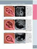 Ostetricia - Diagnostica per immagini