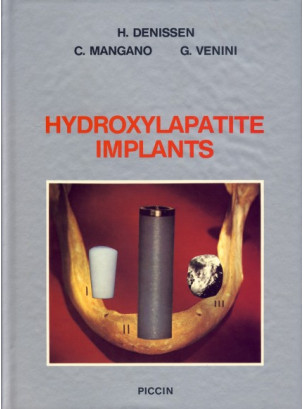 Hydroxylapatite Implants