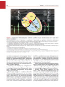 ECG