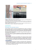 Manuale teorico di tecniche infiltrative ecoguidate nelle patologie muscolo-scheletriche