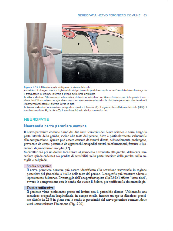 Manuale teorico di tecniche infiltrative ecoguidate nelle patologie muscolo-scheletriche