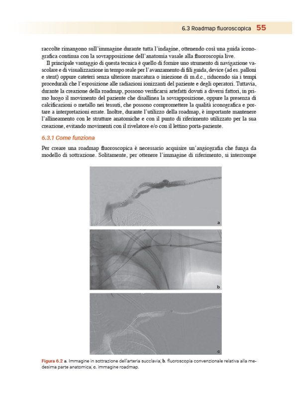 Apparecchiature e radiologia interventistica